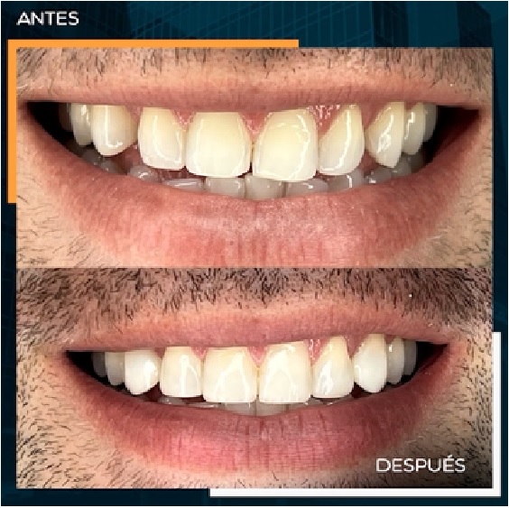CASO1
