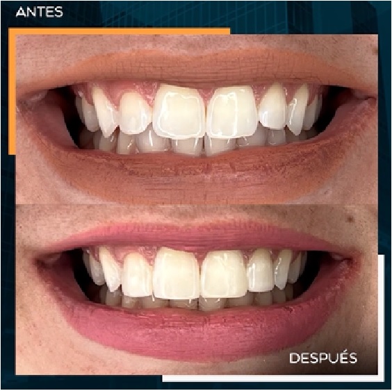 CASO7