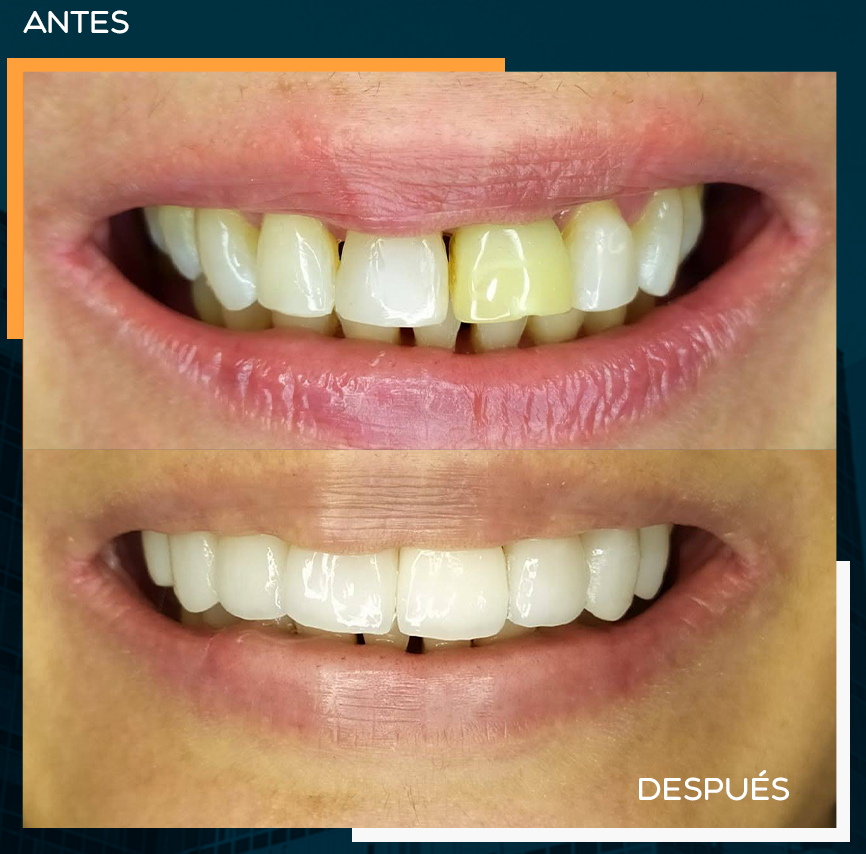 CASO8
