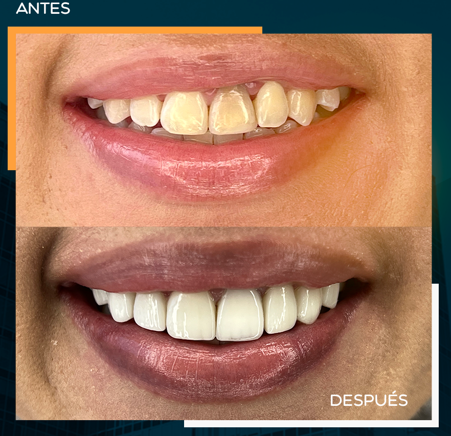 CASO9